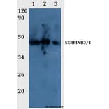 Anti-SERPINB3/4 Antibody from Bioworld Technology (BS60990) - Antibodies.com