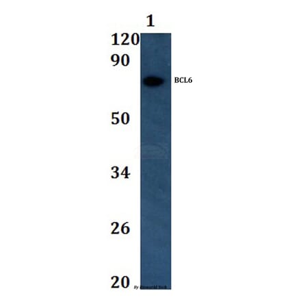 Anti-BCL6 Antibody from Bioworld Technology (BS60991) - Antibodies.com