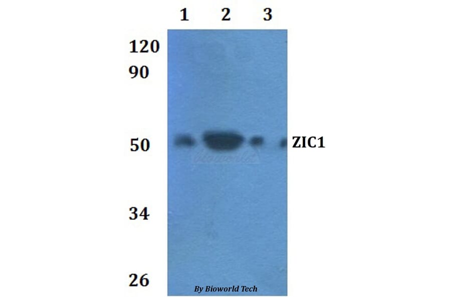 Anti-ZIC1 Antibody from Bioworld Technology (BS61011) - Antibodies.com