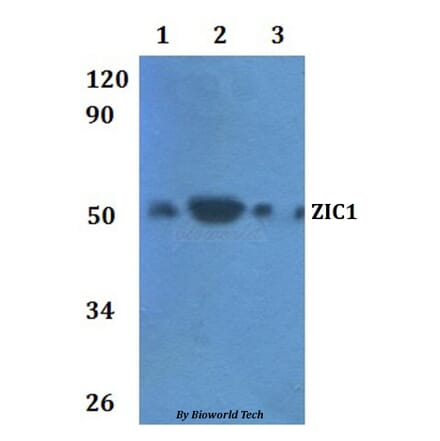 Anti-ZIC1 Antibody from Bioworld Technology (BS61011) - Antibodies.com