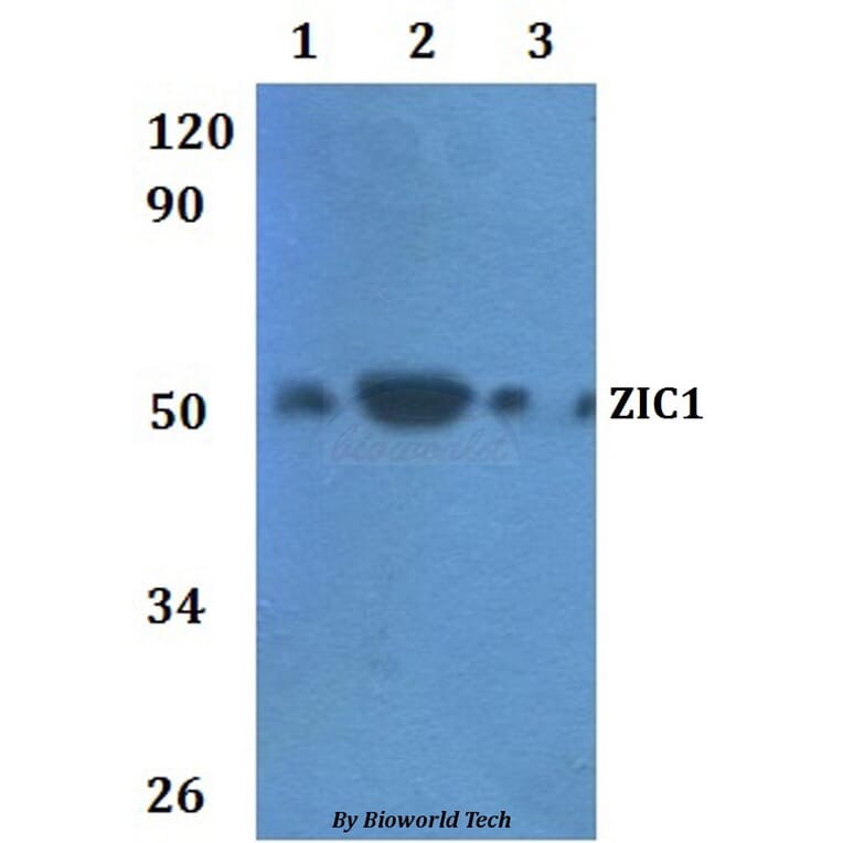 Anti-ZIC1 Antibody from Bioworld Technology (BS61011) - Antibodies.com