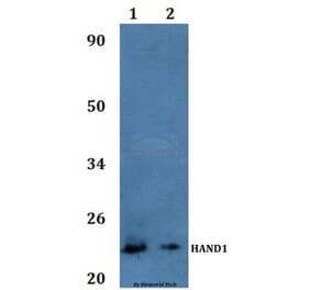 Anti-HAND1 Antibody from Bioworld Technology (BS61014) - Antibodies.com