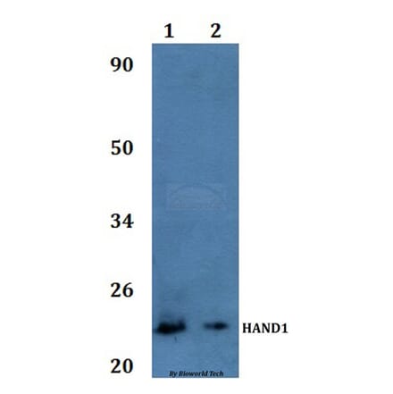 Anti-HAND1 Antibody from Bioworld Technology (BS61014) - Antibodies.com