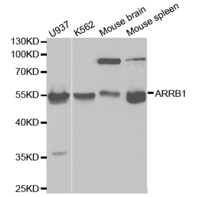 Anti-Arrestin-β-1 Antibody from Bioworld Technology (BS6102) - Antibodies.com