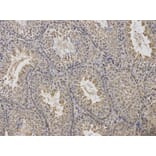 Anti-Arrestin-β-1 Antibody from Bioworld Technology (BS6102) - Antibodies.com