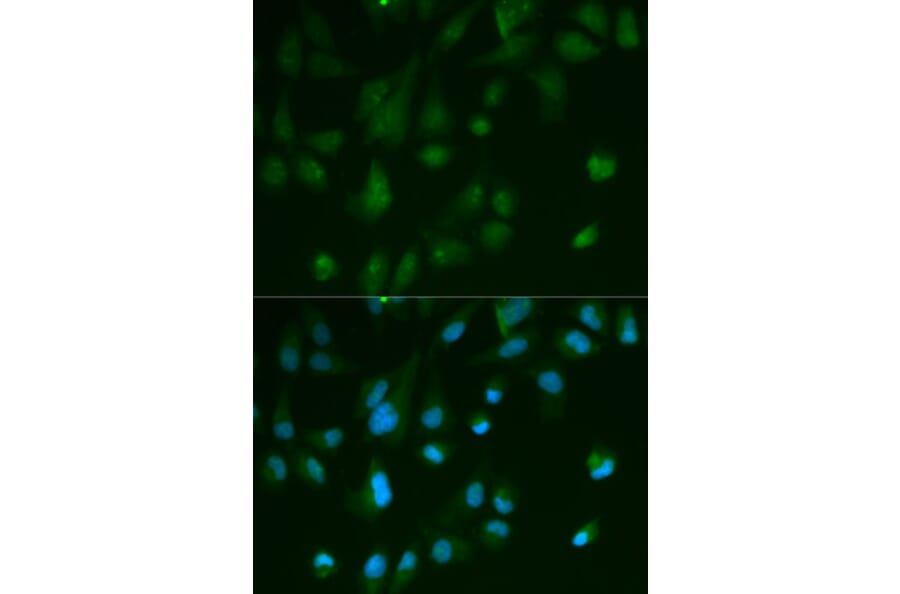 Anti-Arrestin-β-1 Antibody from Bioworld Technology (BS6102) - Antibodies.com