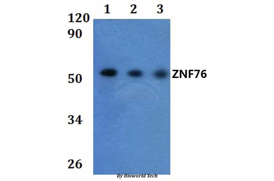 Anti-ZNF76 Antibody from Bioworld Technology (BS61023) - Antibodies.com