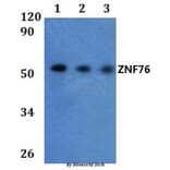 Anti-ZNF76 Antibody from Bioworld Technology (BS61023) - Antibodies.com