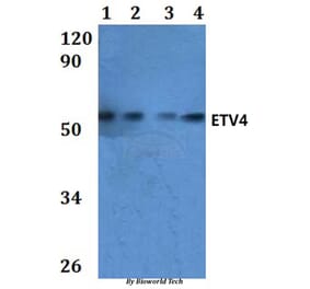 Anti-ETV4 Antibody from Bioworld Technology (BS61024) - Antibodies.com