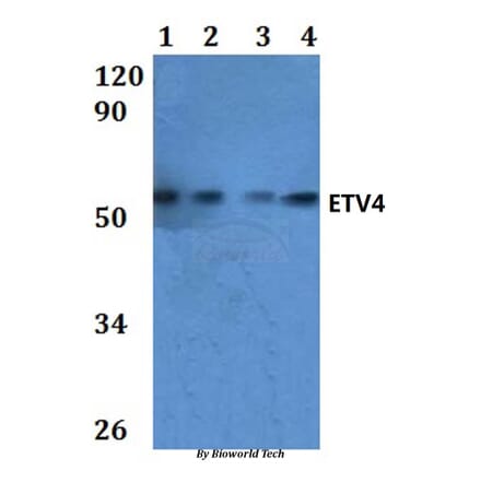 Anti-ETV4 Antibody from Bioworld Technology (BS61024) - Antibodies.com