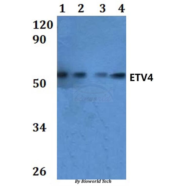 Anti-ETV4 Antibody from Bioworld Technology (BS61024) - Antibodies.com