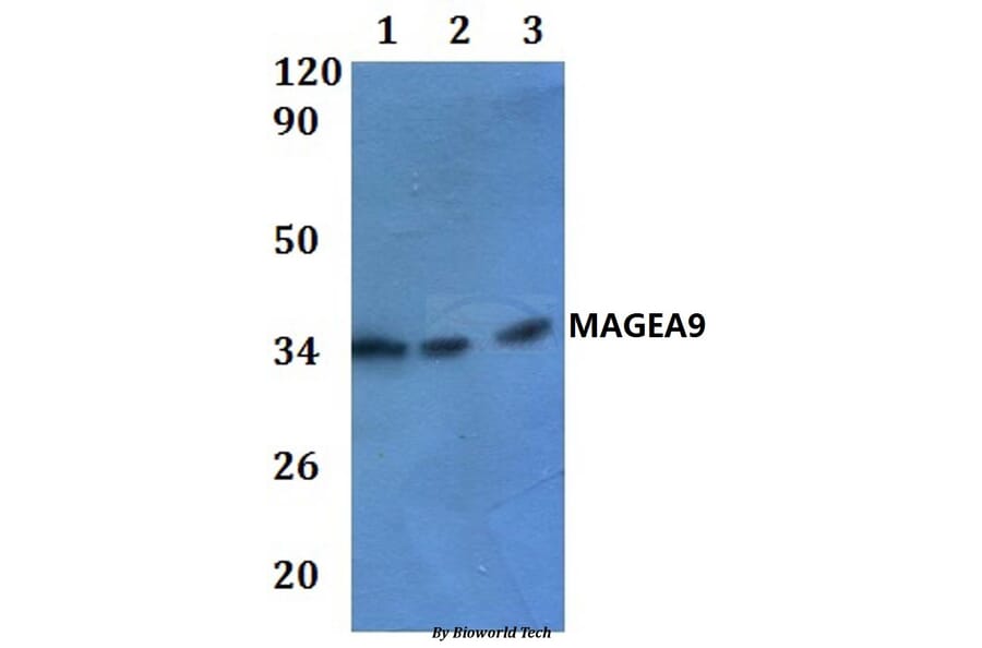 Anti-MAGEA9 Antibody from Bioworld Technology (BS61025) - Antibodies.com
