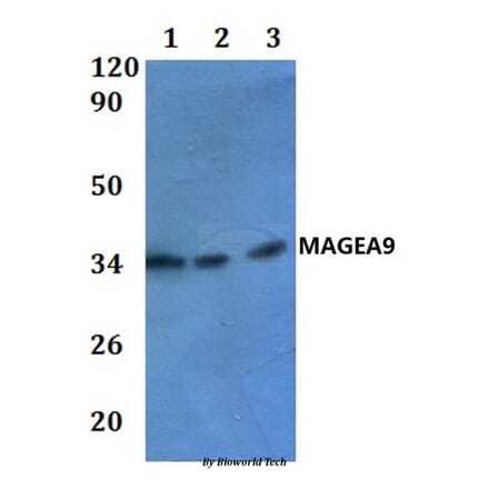 Anti-MAGEA9 Antibody from Bioworld Technology (BS61025) - Antibodies.com