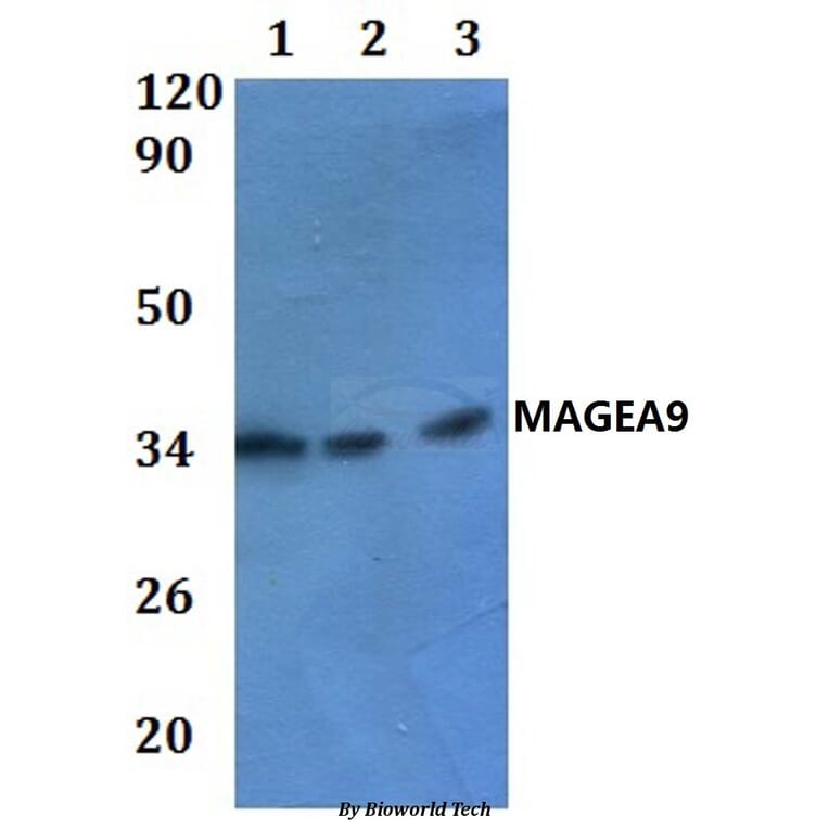 Anti-MAGEA9 Antibody from Bioworld Technology (BS61025) - Antibodies.com