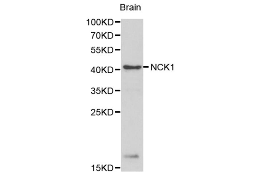 Anti-NCK1 Antibody from Bioworld Technology (BS6103) - Antibodies.com
