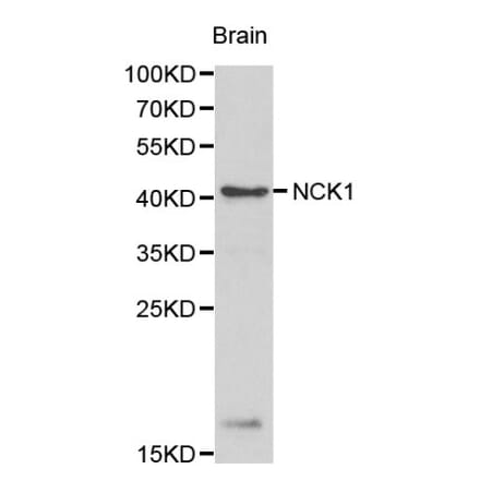 Anti-NCK1 Antibody from Bioworld Technology (BS6103) - Antibodies.com