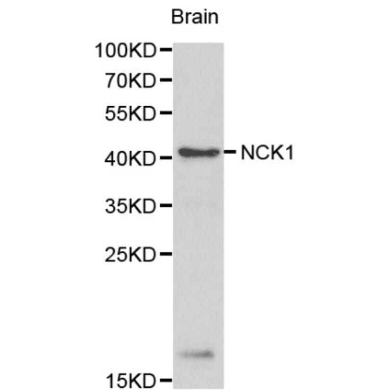 Anti-NCK1 Antibody from Bioworld Technology (BS6103) - Antibodies.com