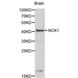 Anti-NCK1 Antibody from Bioworld Technology (BS6103) - Antibodies.com