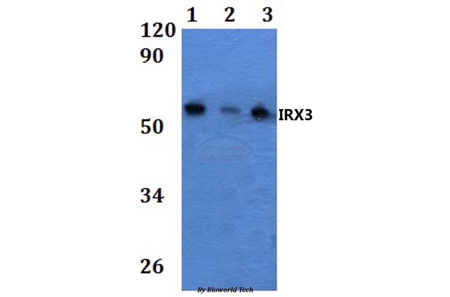 Anti-IRX3 Antibody from Bioworld Technology (BS61032) - Antibodies.com