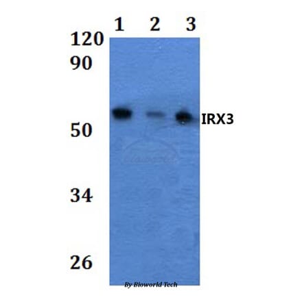 Anti-IRX3 Antibody from Bioworld Technology (BS61032) - Antibodies.com