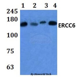 Anti-ERCC6 Antibody from Bioworld Technology (BS61035) - Antibodies.com