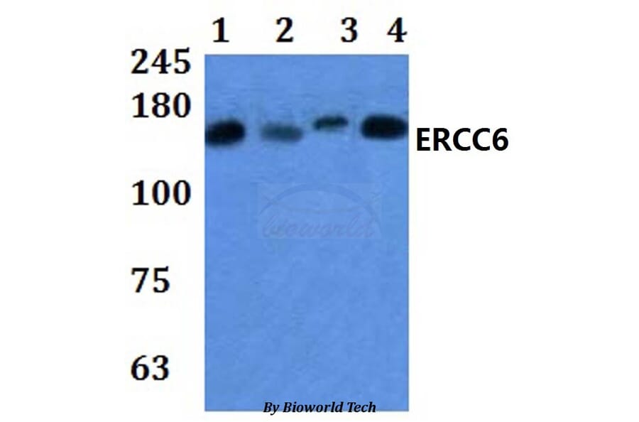 Anti-ERCC6 Antibody from Bioworld Technology (BS61035) - Antibodies.com
