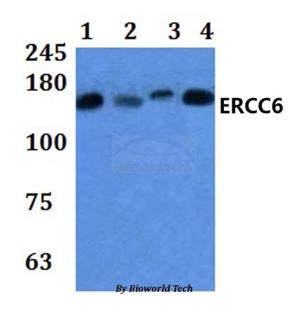 Anti-ERCC6 Antibody from Bioworld Technology (BS61035) - Antibodies.com