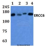Anti-ERCC6 Antibody from Bioworld Technology (BS61035) - Antibodies.com