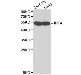 Anti-IRF-4 Antibody from Bioworld Technology (BS6104) - Antibodies.com