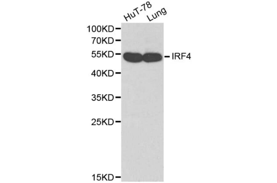Anti-IRF-4 Antibody from Bioworld Technology (BS6104) - Antibodies.com
