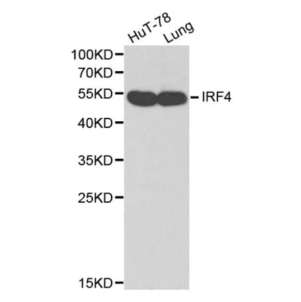 Anti-IRF-4 Antibody from Bioworld Technology (BS6104) - Antibodies.com