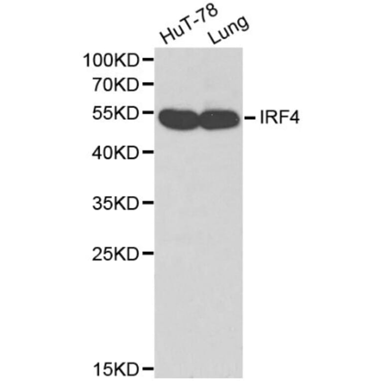Anti-IRF-4 Antibody from Bioworld Technology (BS6104) - Antibodies.com