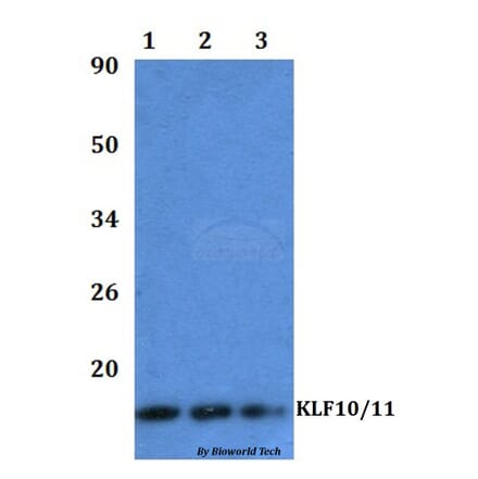 Anti-KLF10/KLF11 Antibody from Bioworld Technology (BS61041) - Antibodies.com