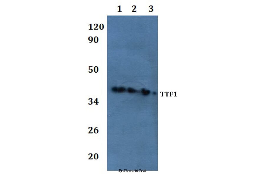 Anti-TTF1 Antibody from Bioworld Technology (BS61047) - Antibodies.com