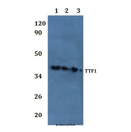 Anti-TTF1 Antibody from Bioworld Technology (BS61047) - Antibodies.com