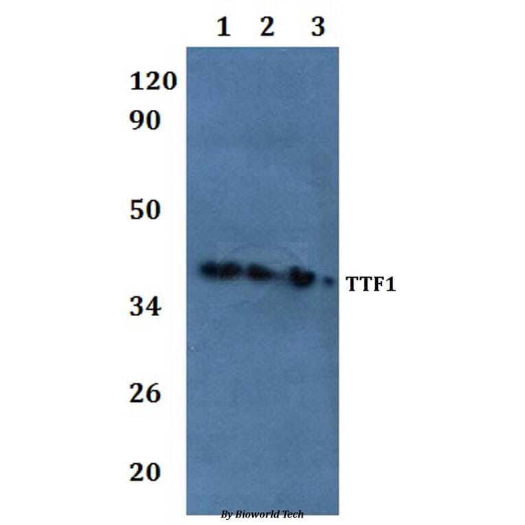 Anti-TTF1 Antibody from Bioworld Technology (BS61047) - Antibodies.com