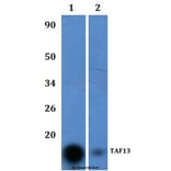 Anti-TAF13 Antibody from Bioworld Technology (BS61048) - Antibodies.com