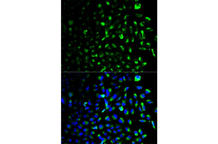 Anti-HXK I Antibody from Bioworld Technology (BS6105) - Antibodies.com
