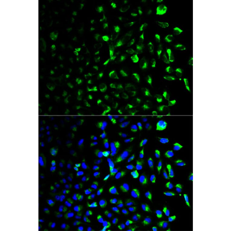 Anti-HXK I Antibody from Bioworld Technology (BS6105) - Antibodies.com