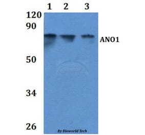 Anti-ANO1 Antibody from Bioworld Technology (BS61052) - Antibodies.com
