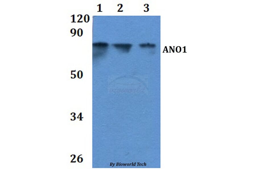 Anti-ANO1 Antibody from Bioworld Technology (BS61052) - Antibodies.com