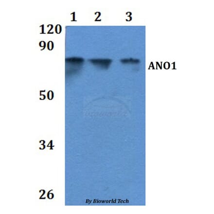 Anti-ANO1 Antibody from Bioworld Technology (BS61052) - Antibodies.com