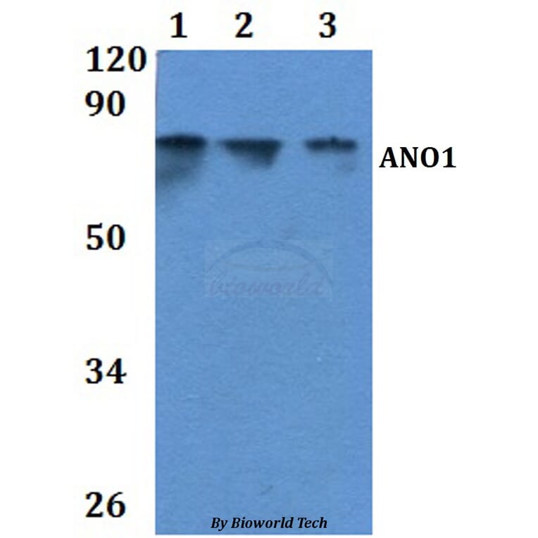 Anti-ANO1 Antibody from Bioworld Technology (BS61052) - Antibodies.com
