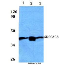 Anti-SDCCAG8 Antibody from Bioworld Technology (BS61055) - Antibodies.com