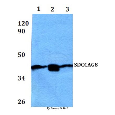 Anti-SDCCAG8 Antibody from Bioworld Technology (BS61055) - Antibodies.com