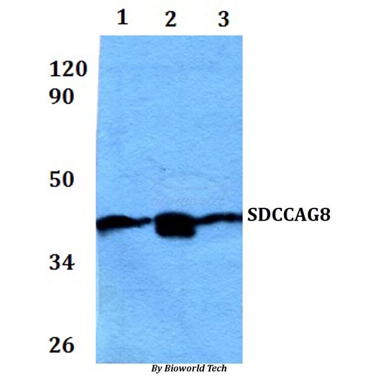 Anti-SDCCAG8 Antibody from Bioworld Technology (BS61055) - Antibodies.com