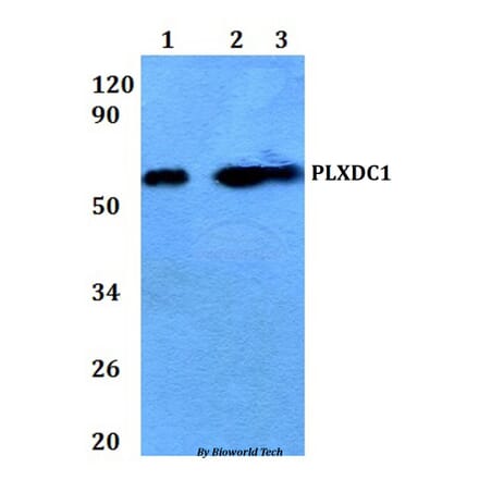 Anti-PLXDC1 Antibody from Bioworld Technology (BS61057) - Antibodies.com
