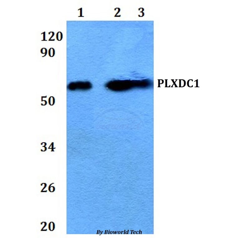 Anti-PLXDC1 Antibody from Bioworld Technology (BS61057) - Antibodies.com