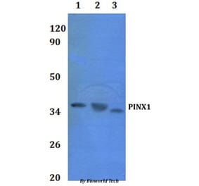Anti-PINX1 Antibody from Bioworld Technology (BS61061) - Antibodies.com