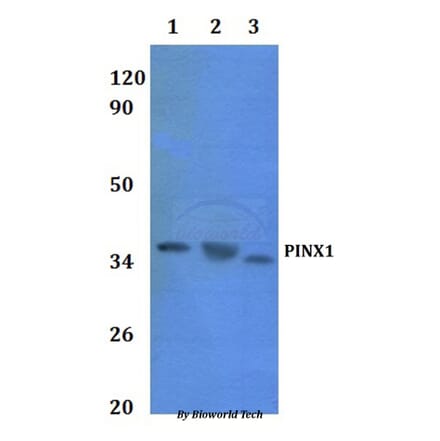 Anti-PINX1 Antibody from Bioworld Technology (BS61061) - Antibodies.com